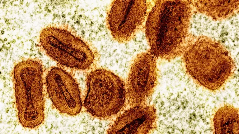 Canada confirms first case of clade I mpox in Canada